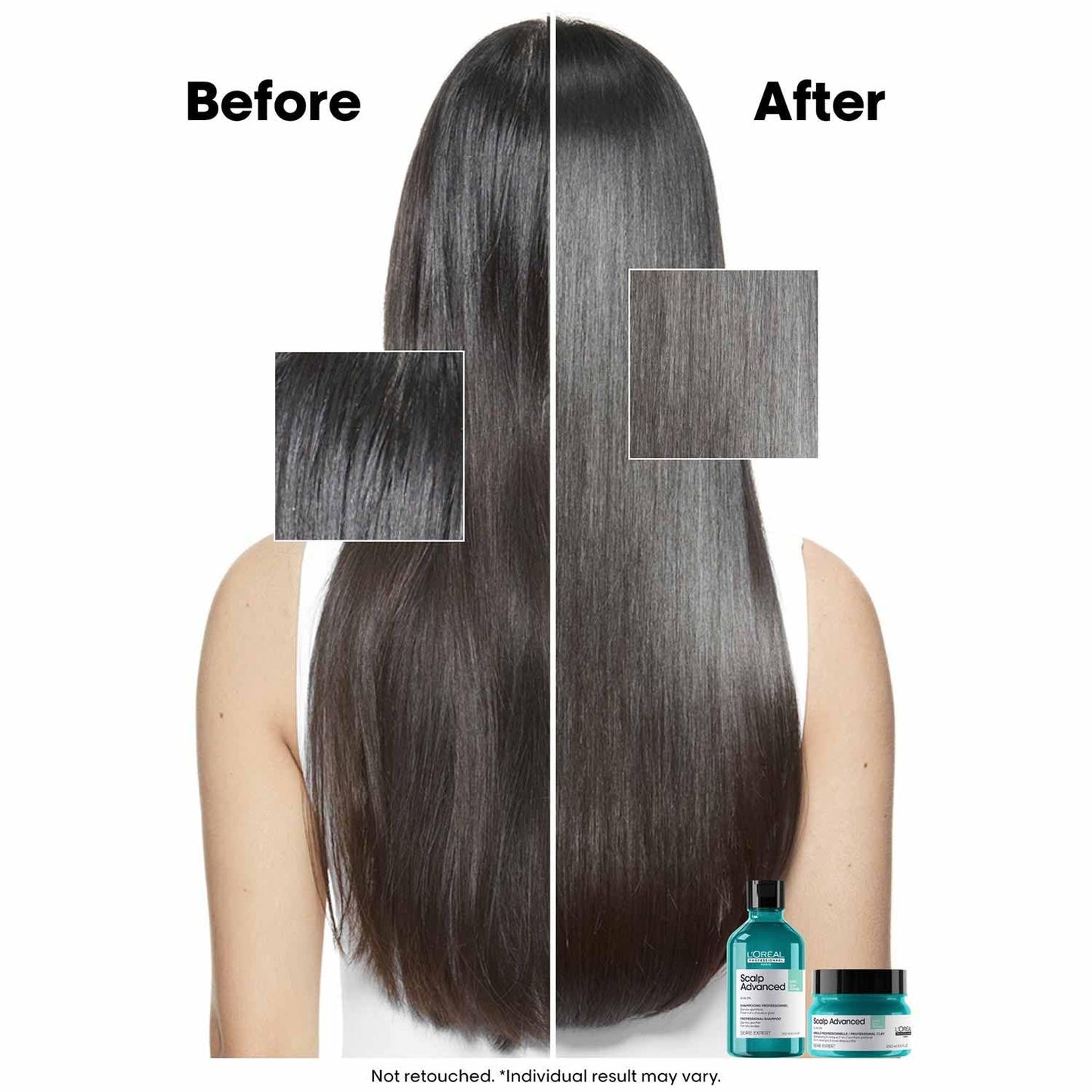 LP SE SCALP A-OILY SHP 300ML R VG61