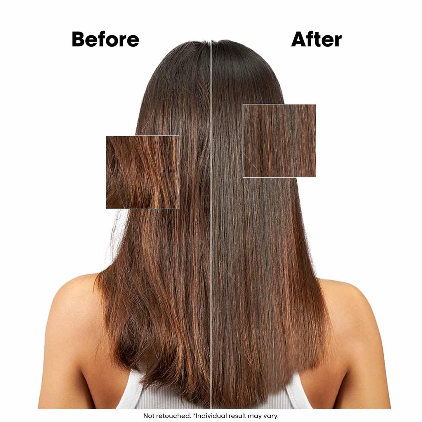 Xtenso Care Reno Serum 50 ml.