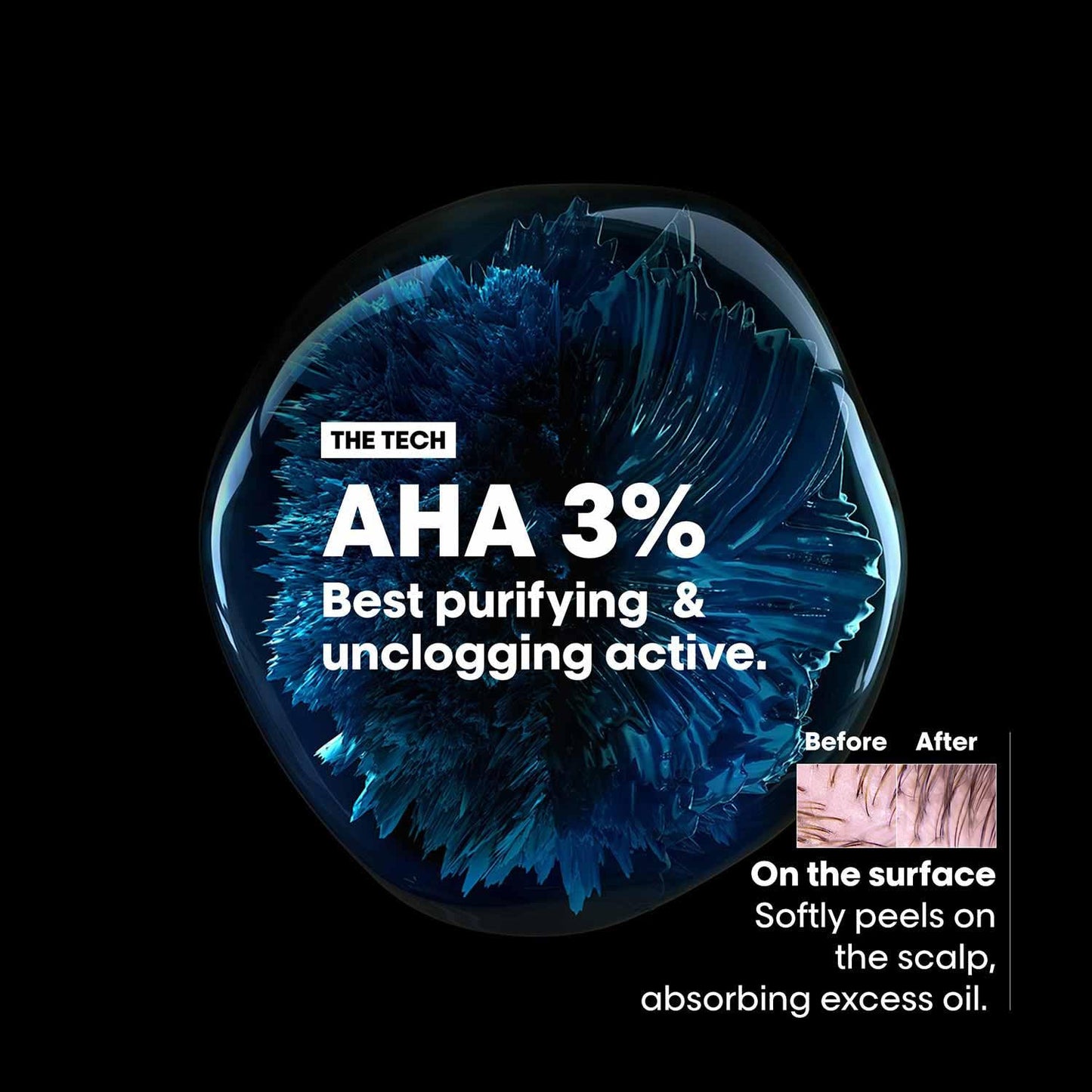 LP SE SCALP A-OILY SHP 300ML R VG61