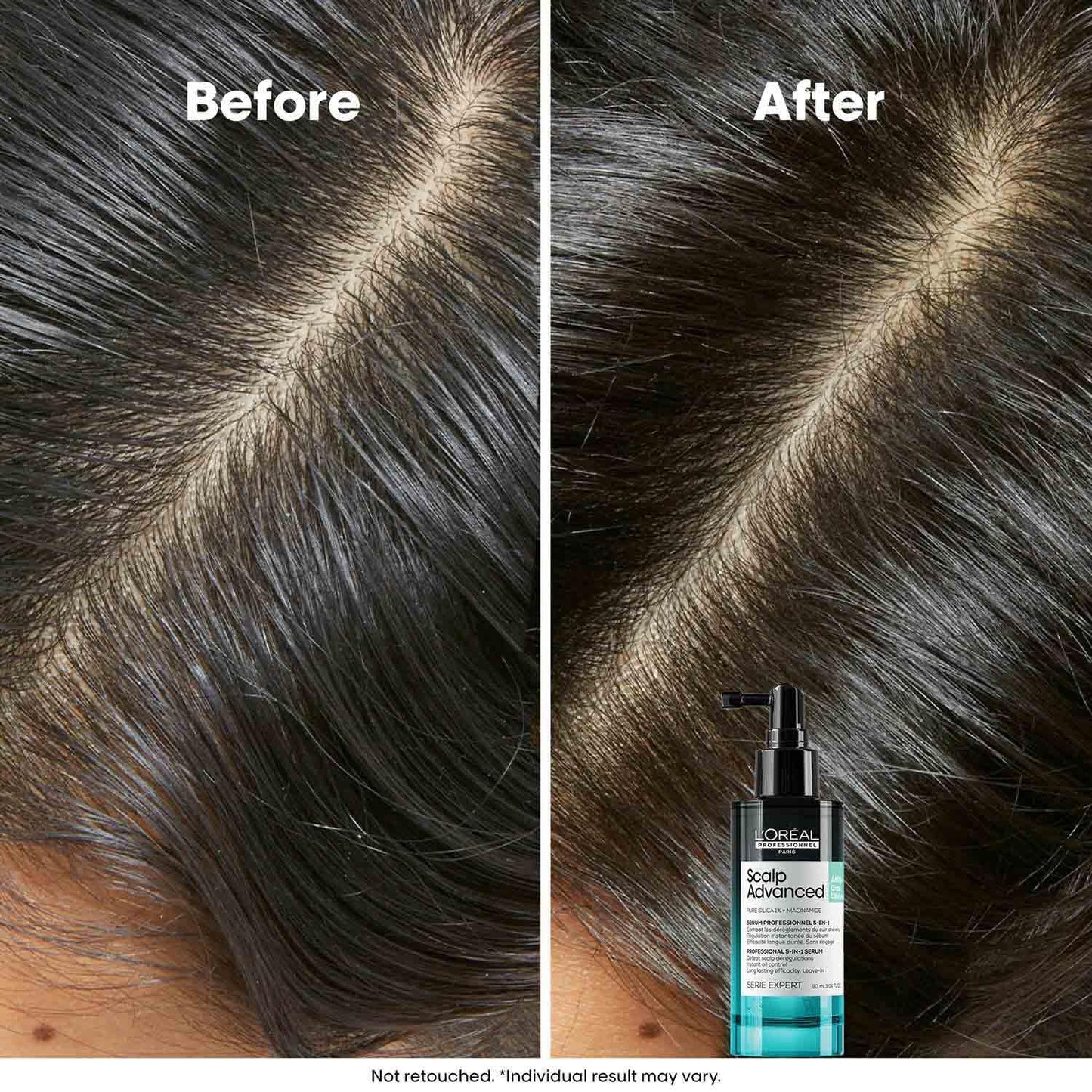 LP SE Serioxyl Dens 90ml JPN V297.