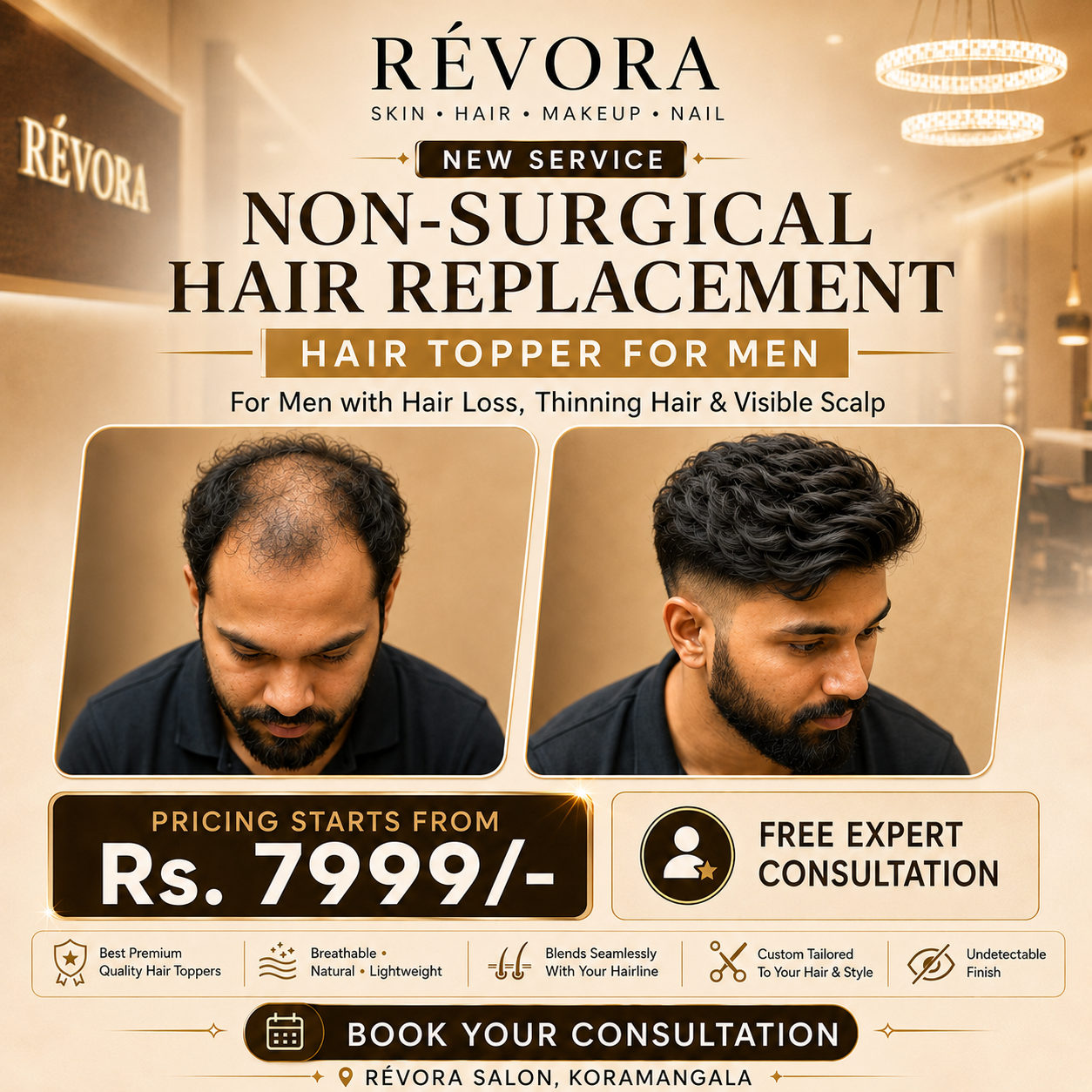 Men’s Hair Topper Consultation – Free Expert Advice | Non Surgical Hair Replacement for Men