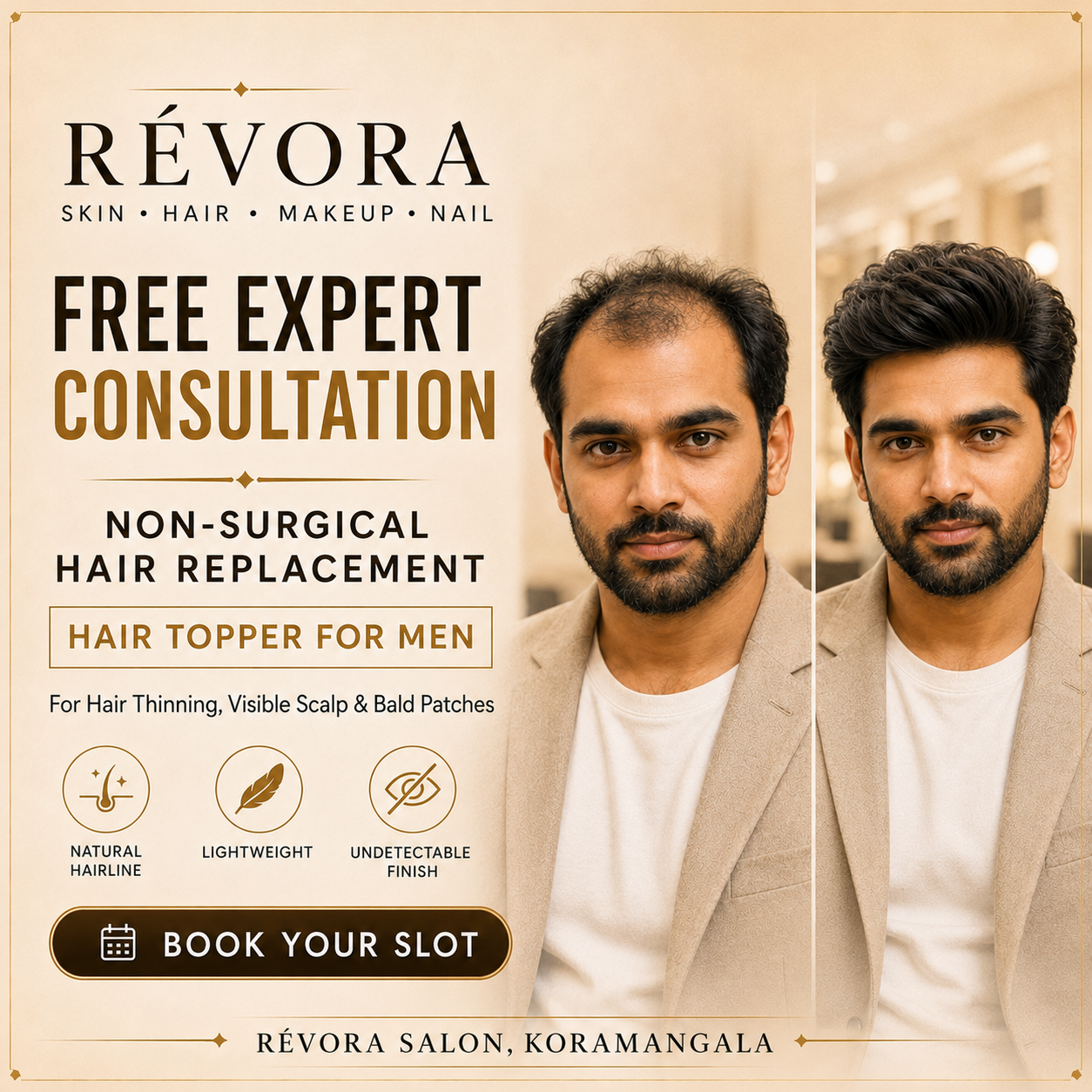 Men’s Hair Topper Consultation – Free Expert Advice | Non Surgical Hair Replacement for Men